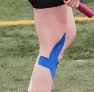 How To Tape Back of Knee for Stability